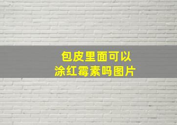 包皮里面可以涂红霉素吗图片