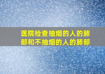 医院检查抽烟的人的肺部和不抽烟的人的肺部