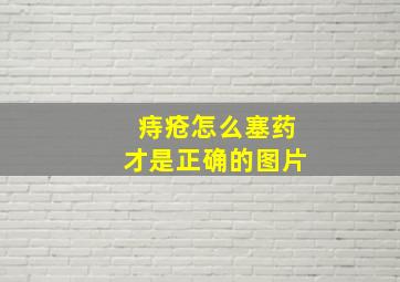 痔疮怎么塞药才是正确的图片