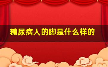 糖尿病人的脚是什么样的