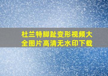 杜兰特脚趾变形视频大全图片高清无水印下载