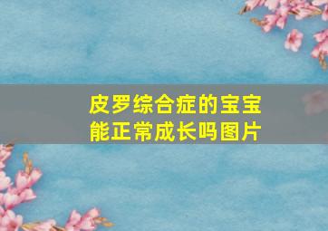 皮罗综合症的宝宝能正常成长吗图片